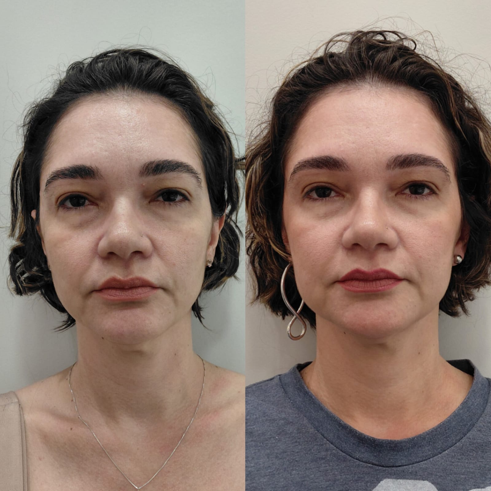 WhatsApp Image 2026-03-03 at 15.38.37.jpeg